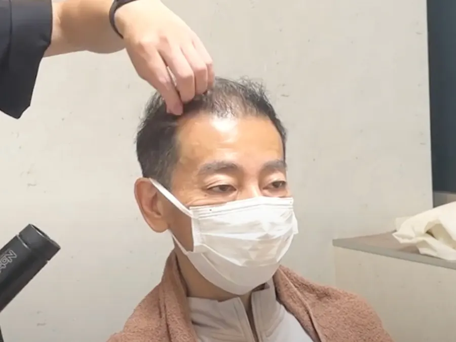 頭頂做出份量把視線帶離髮際線