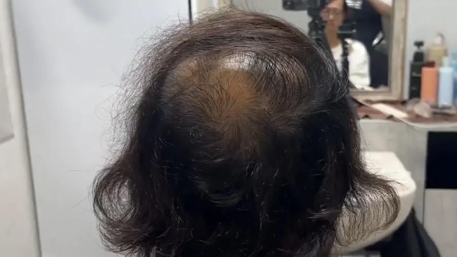 把瀏海往上梳，再讓髮尾蓋到髮旋的位置。