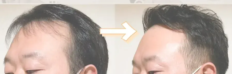 後尾枕電髮前後對比